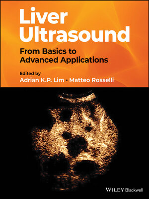 cover image of Liver Ultrasound